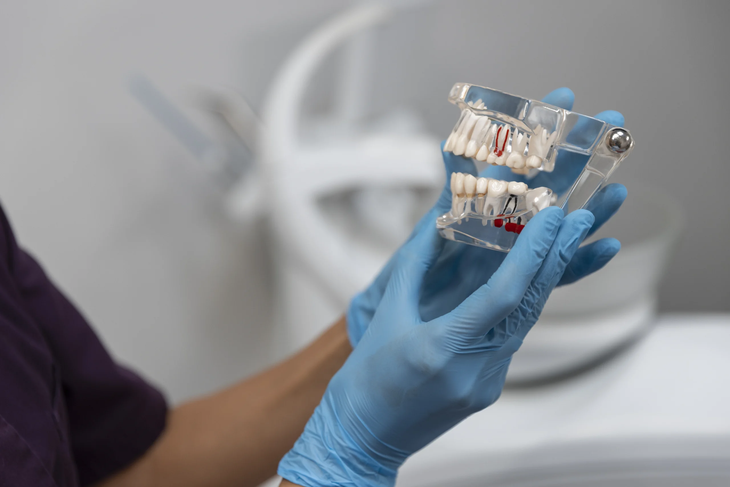 Need of Dental Crown