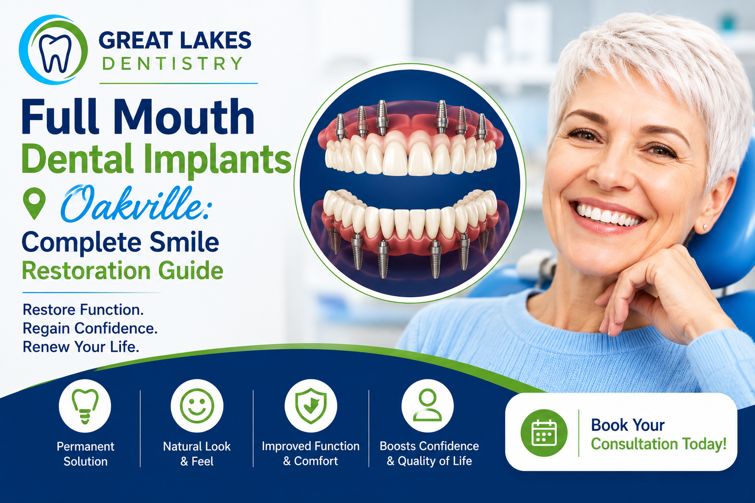 Full Mouth Dental Implants