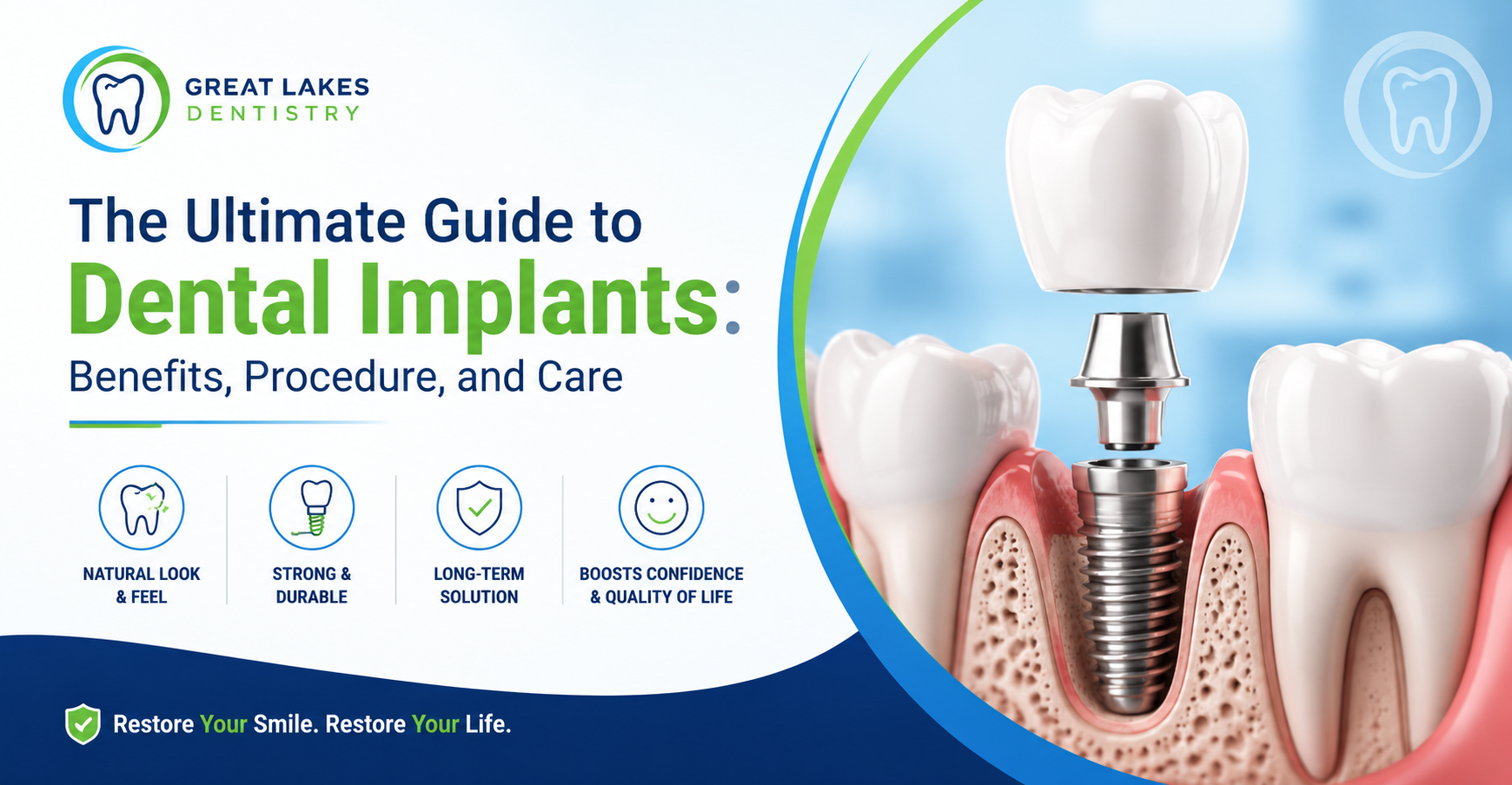 The Ultimate Guide to Dental Implants: Benefits, Procedure, and Care