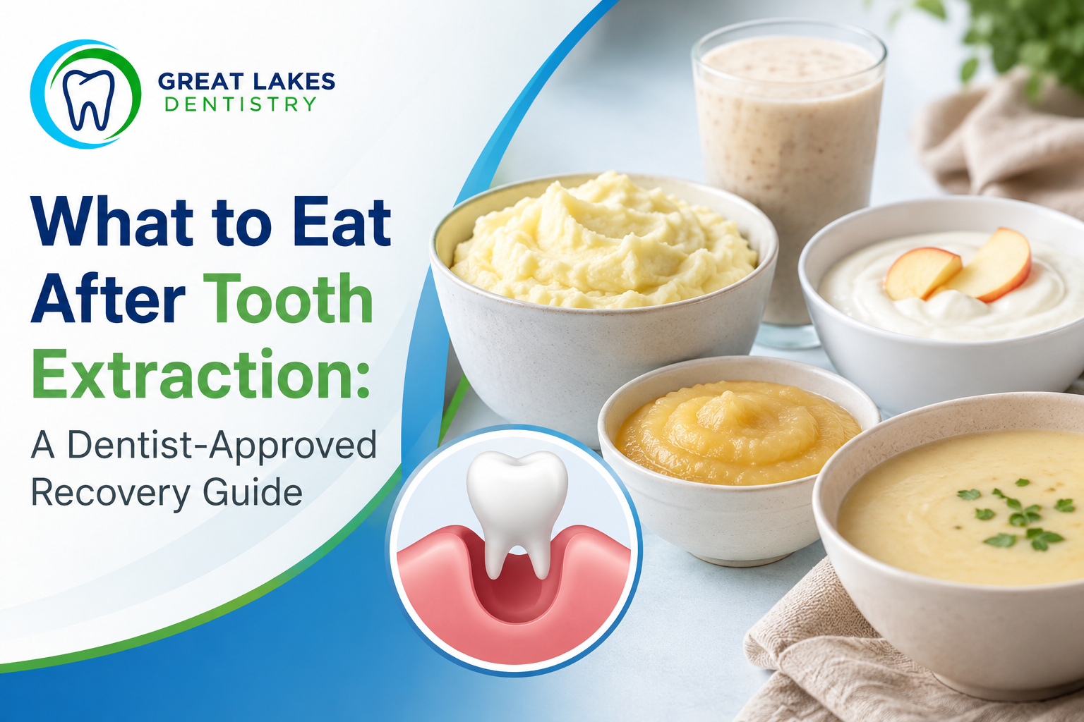 What to Eat After Tooth Extraction A Dentist-Approved Recovery Guide