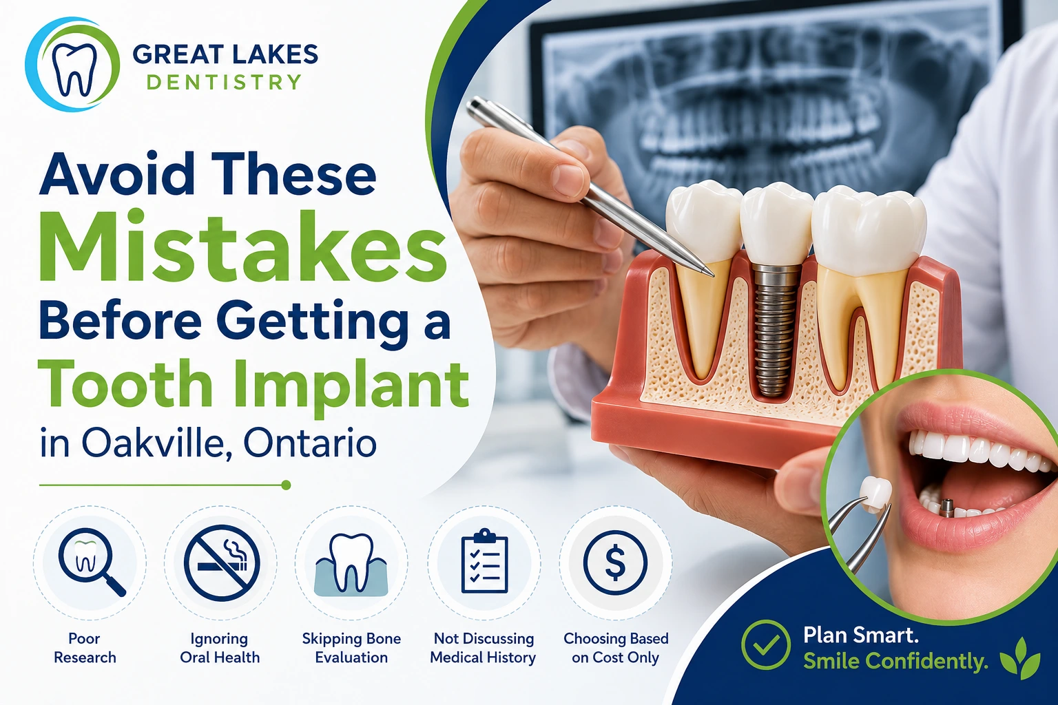 Tooth Implant in Oakville, Ontario
