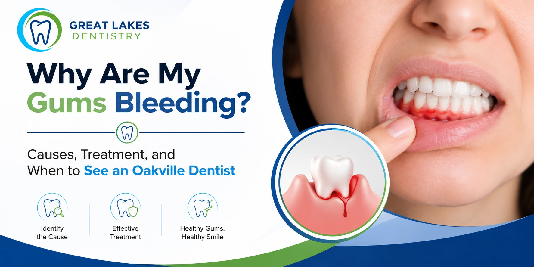Why Are My Gums Bleeding Causes, Treatment, and When to See an Oakville Dentist